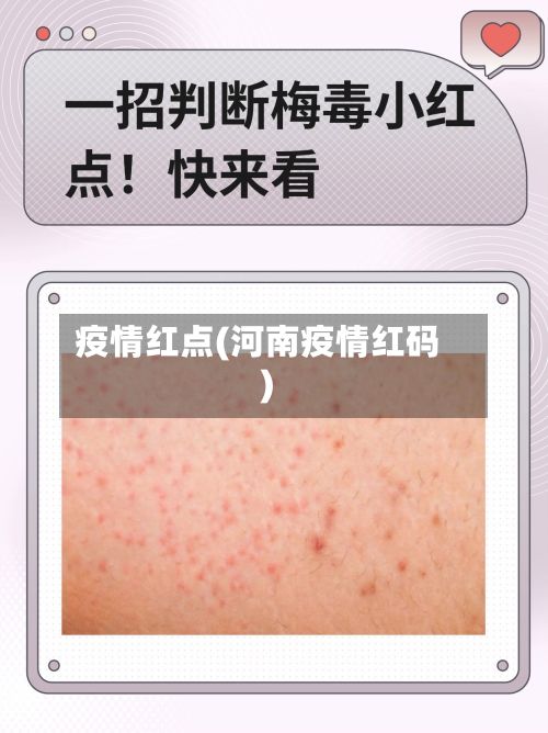 疫情红点(河南疫情红码)